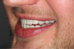 Mateusz_left_after.jpg
