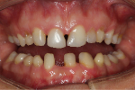 Jamina_smile_bef2.jpg