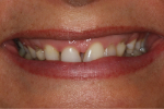 Jamina_smile_bef1.jpg