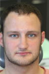 Mateusz_face_bef.jpg