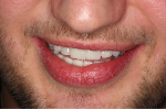 Mateusz_smile_close_after.jpg