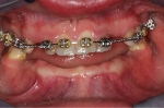 Mateusz_noteeth.jpg