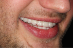 Mateusz_right_after.jpg