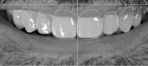 DSD Digital Smile Design