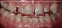 DSD Digital Smile Design