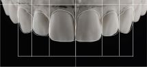 DSD Digital Smile Design